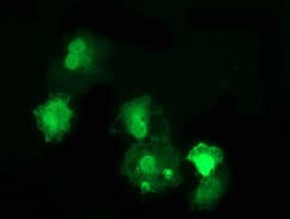 DNAJB1 / Hsp40 Antibody (clone OTI1G4)
