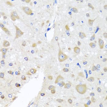EIF3M / PCID1 Antibody
