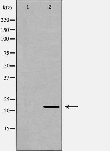IFNA1 / Interferon Alpha 1 Antibody