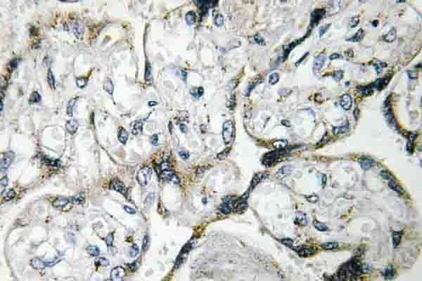 PAK1 Antibody (Glu195)