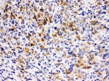 CCT5 / TCP1 Epsilon Antibody