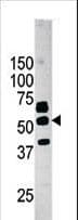 PANK2 Antibody (aa65-95)