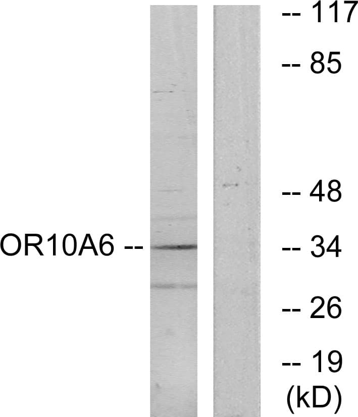 OR10A6 Antibody (aa241-290)