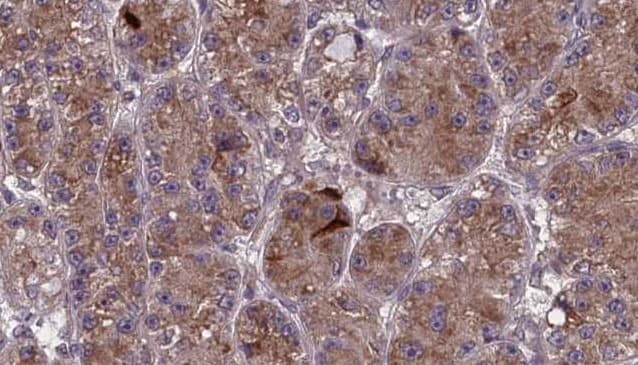Polyclonal Rabbit anti-Human Olfactory Receptor OR2V1 Antibody (IHC, WB)