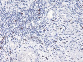 SERPINB2 / PAI-2 Antibody (clone 1G3, Carrier-free)
