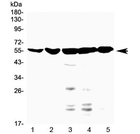 Polyclonal Rabbit anti-Human NR1H4 / FXR Antibody (WB)