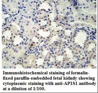 AP1S1 Antibody (aa21-133)