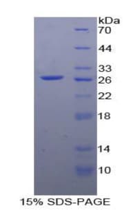 Human PTGER2 / EP2 Protein (Recombinant His-T7)
