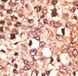 CRY1 Antibody (aa556-586)