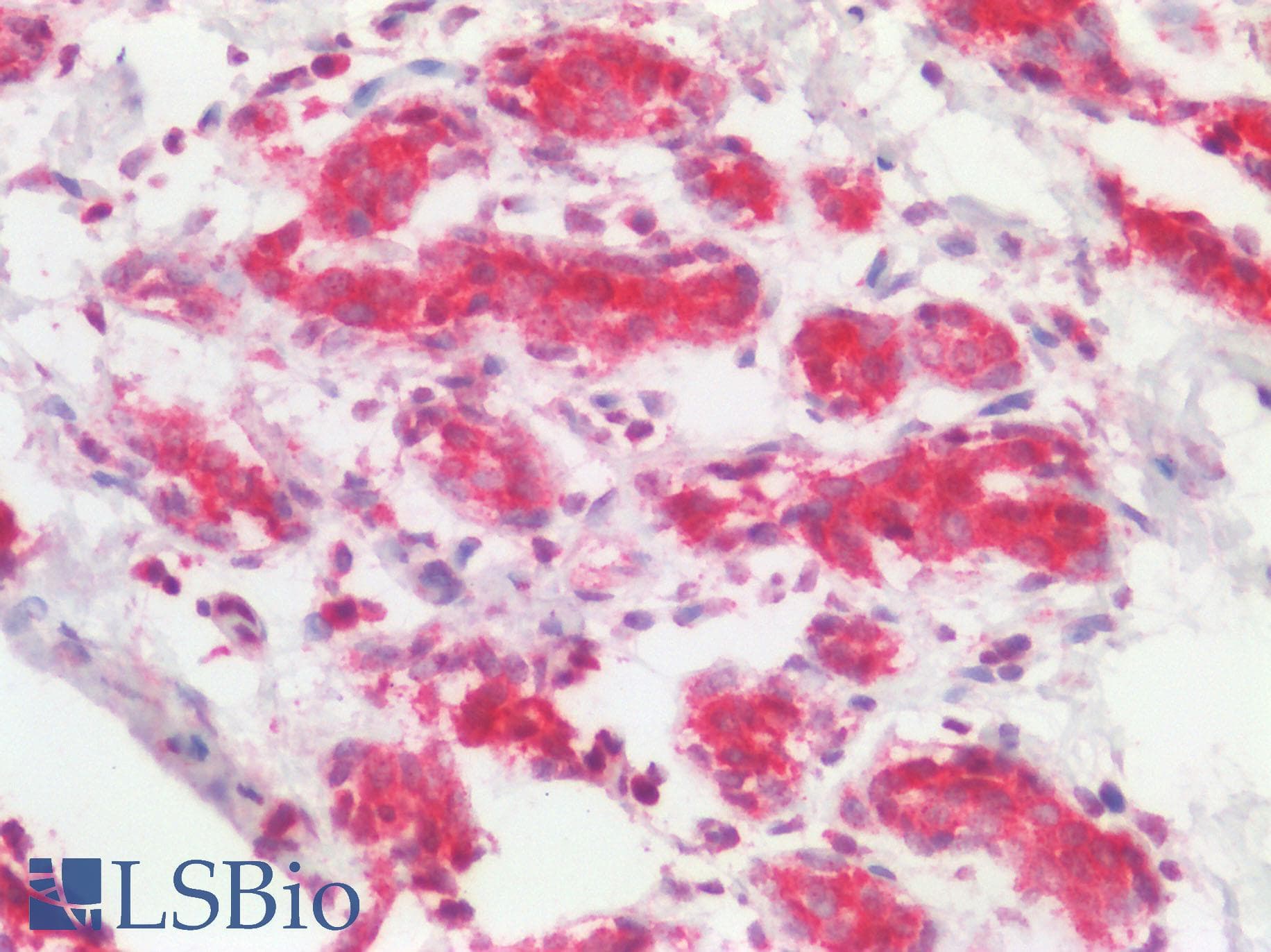 Polyclonal Rabbit anti-Human TSLP Antibody (IHC, IF, WB)