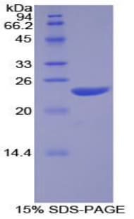 Human NOS1 / nNOS Protein (Recombinant His)