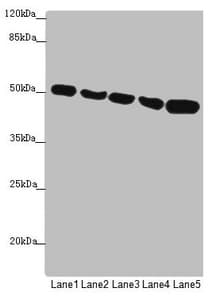 Polyclonal Rabbit anti-Human SUCLA2 Antibody (IHC, WB)