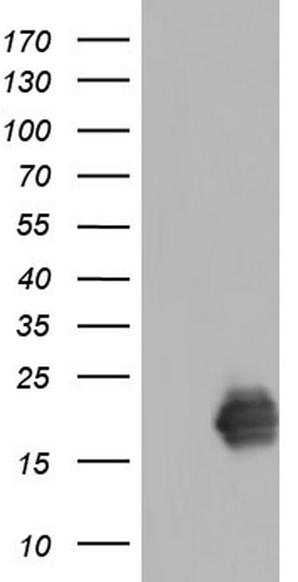 TNNC1 / Cardiac Troponin C Antibody (clone OTI8F8)