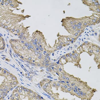 Polyclonal Rabbit anti-Human IFN Gamma / Interferon Gamma Antibody (IHC, WB)