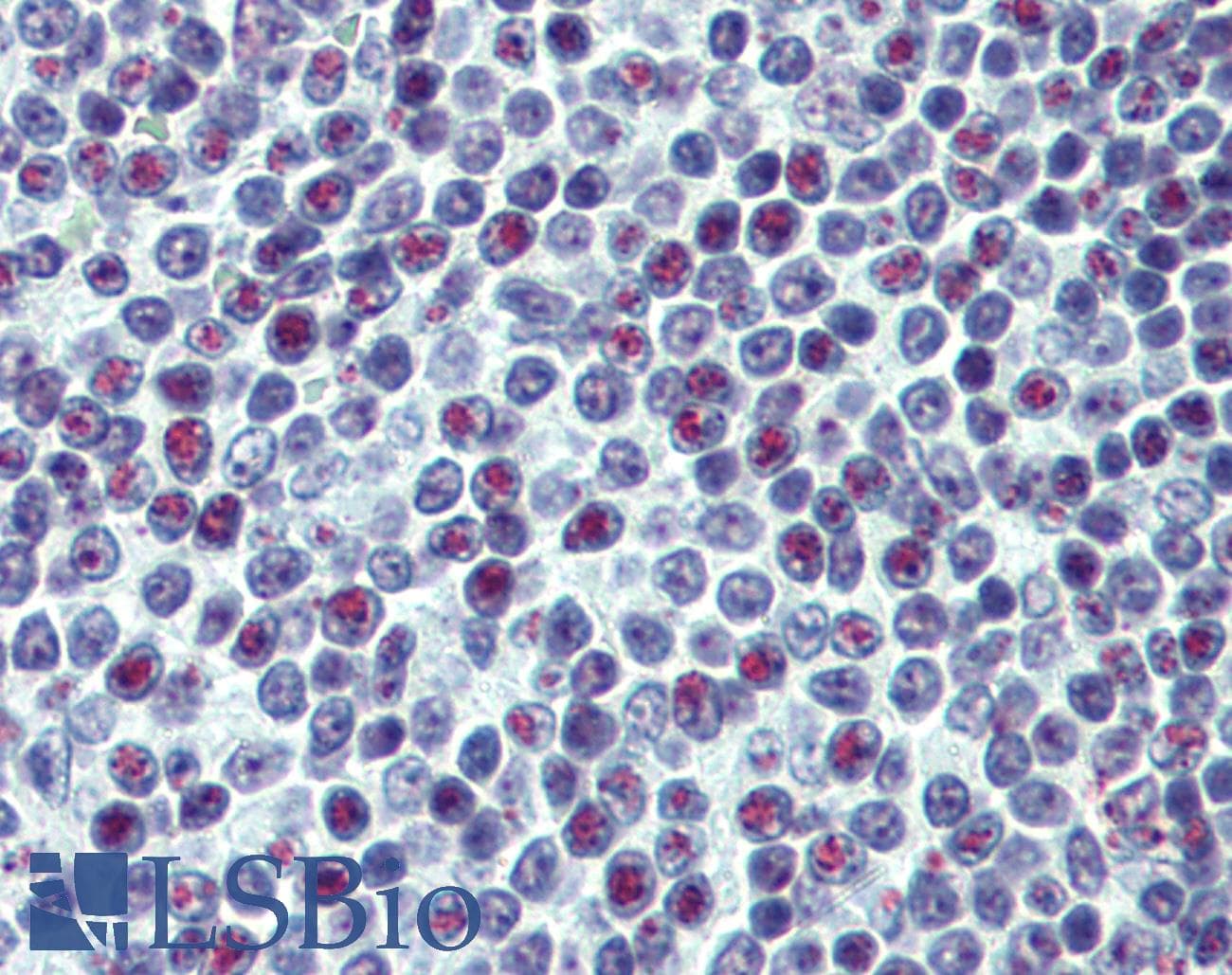 IHC-plus™ UBTF / UBF Antibody (clone 1A2)