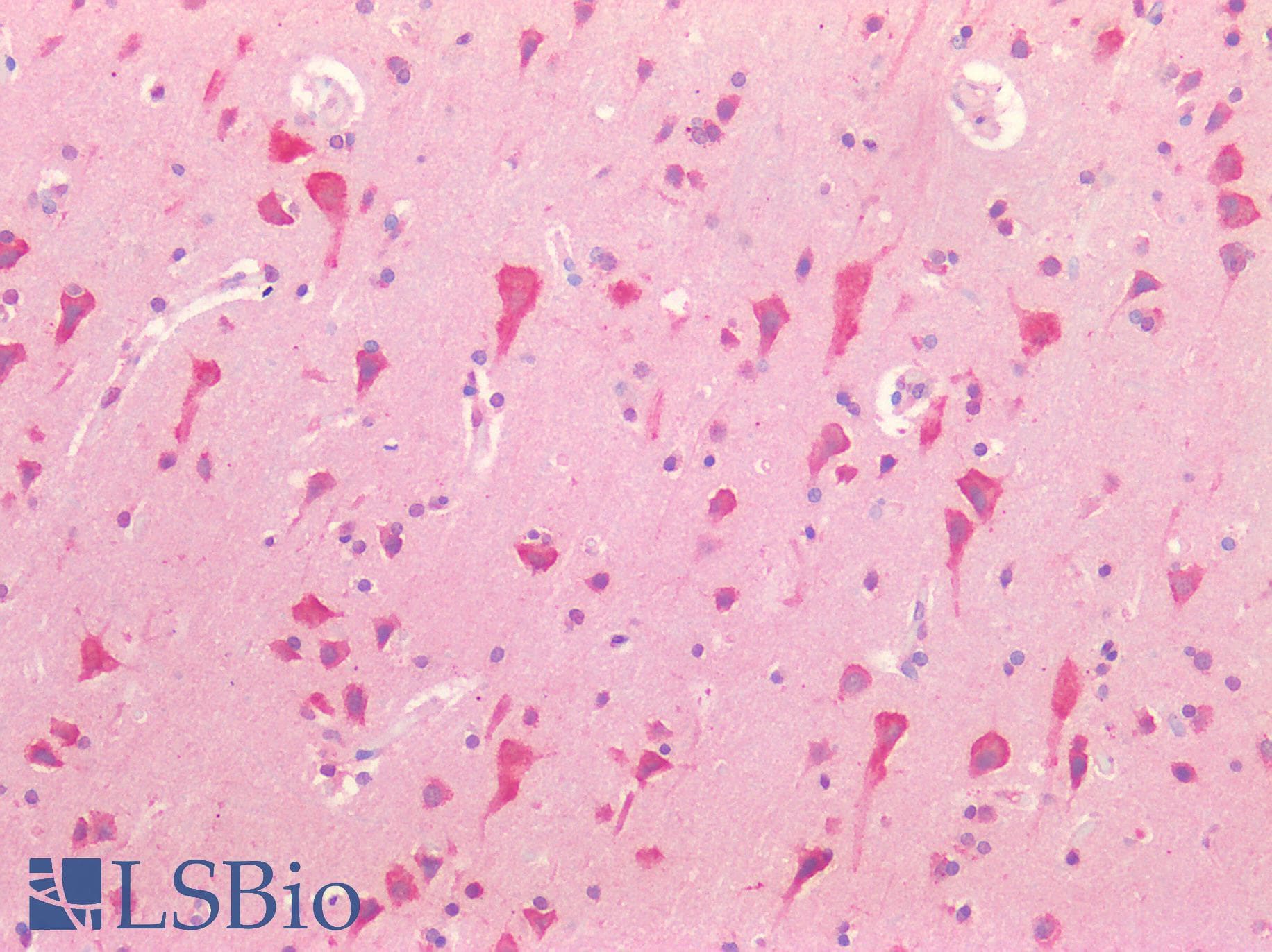IHC-plus™ TH / Tyrosine Hydroxylase Antibody