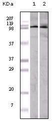 EPHA1 / EPH Receptor A1 Antibody (clone 5D2)