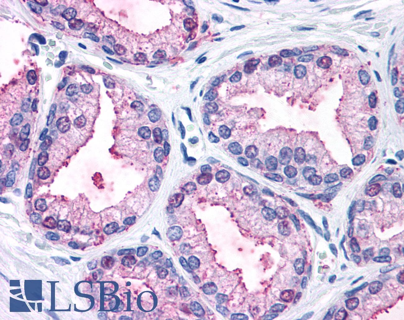 PathPlus™ Polyclonal Rabbit anti-Human MAPK3 / ERK1 Antibody (Internal, IHC)