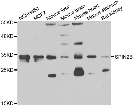 SPIN2B Antibody