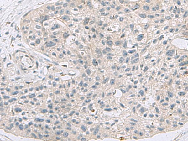 ABCA10 Antibody