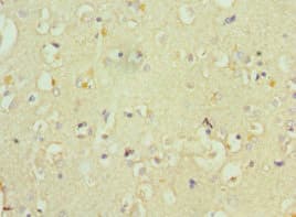 Polyclonal Rabbit anti-Human WC1 / ATP7B Antibody (aa1166-1465, IHC)