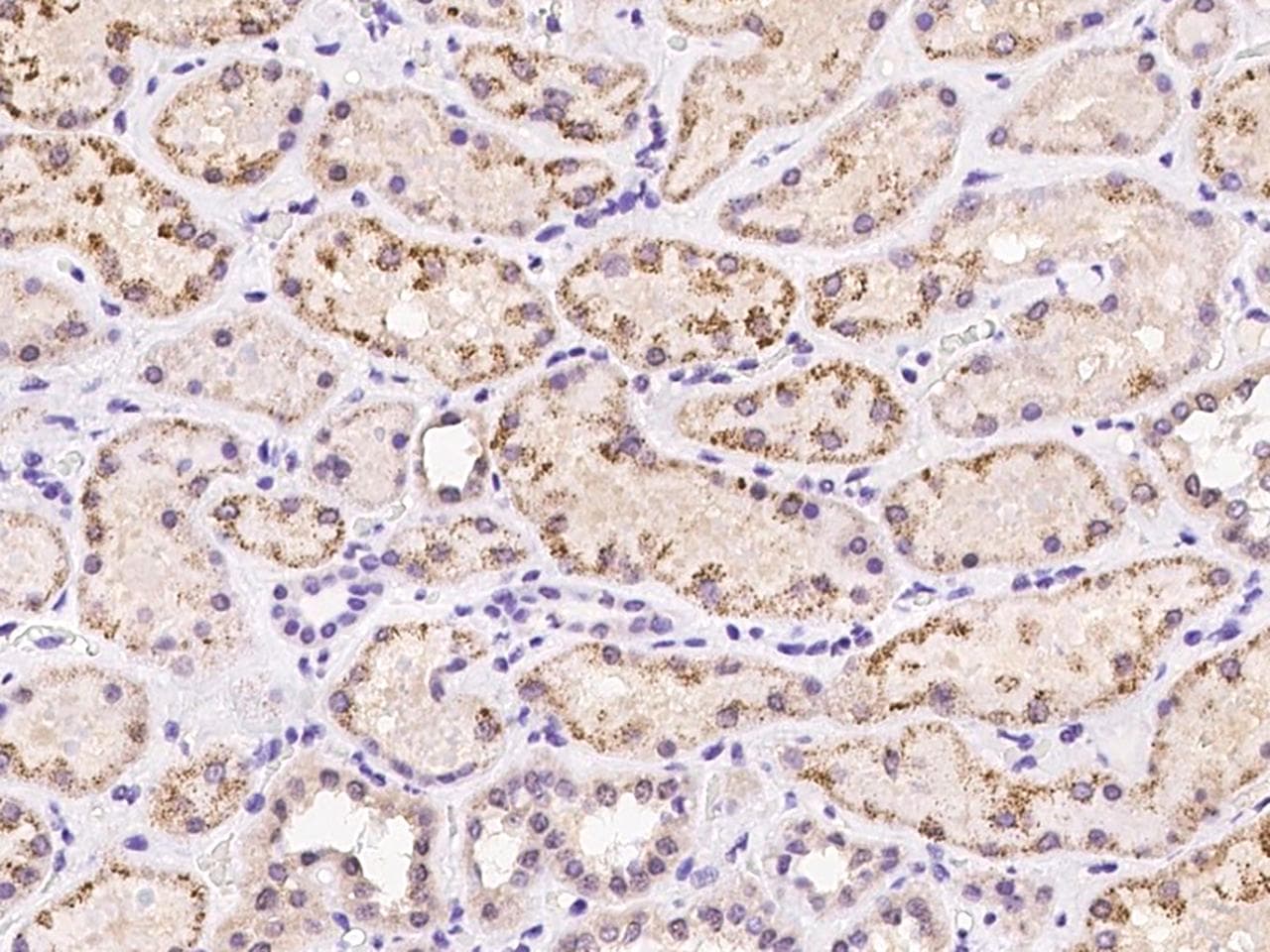 C17orf71 Antibody