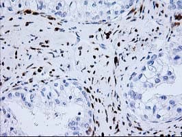 NUDEL / NDEL1 Antibody (clone OTI5E11)