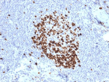 MKI67 / Ki67 Antibody (clone MKI67/2466)