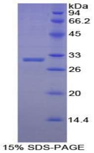 Human EBF2 Protein (Recombinant His-T7)