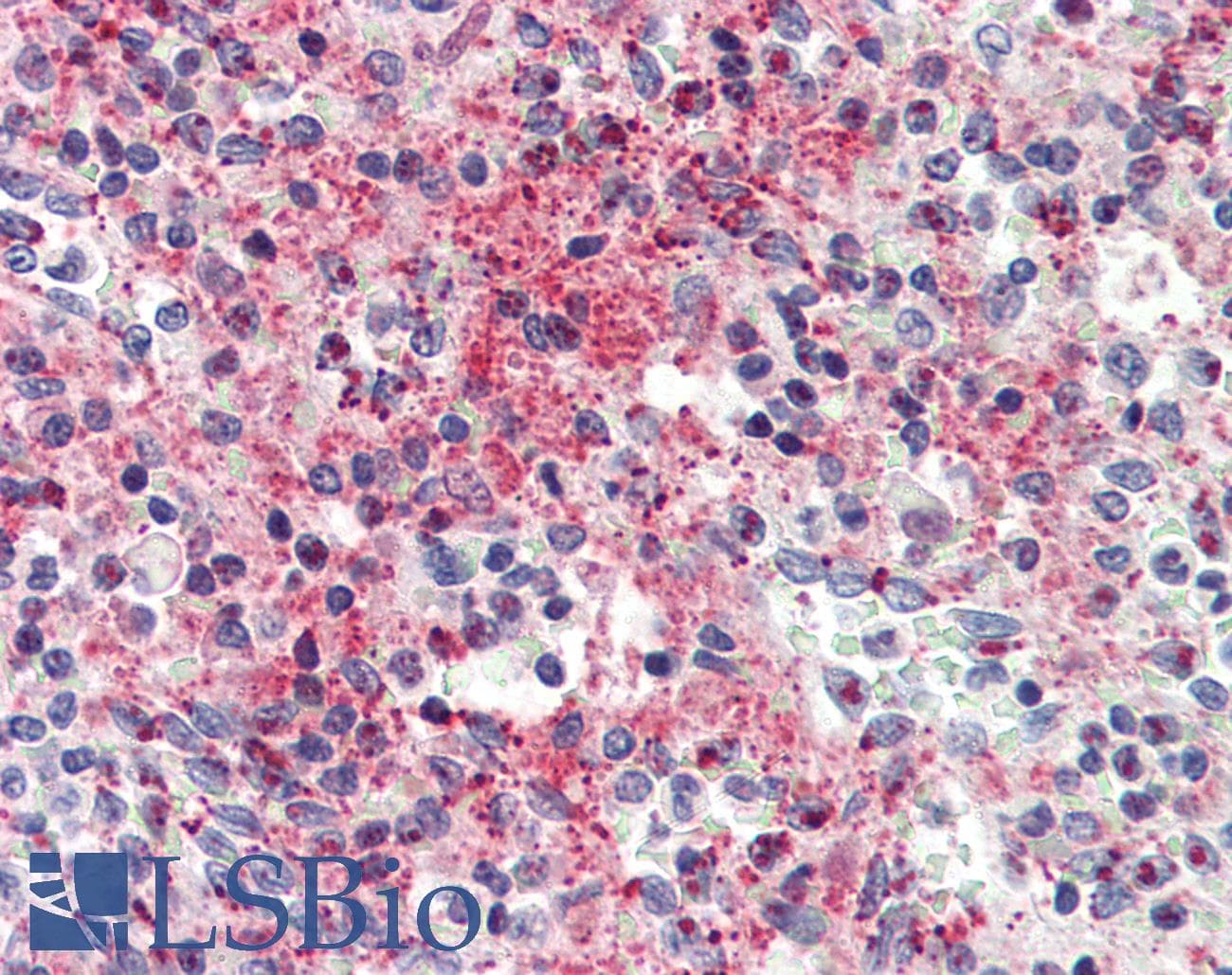 IHC-plus™ Monoclonal Mouse anti-Human CCL5 / RANTES Antibody (clone 8.PP.11, IHC)