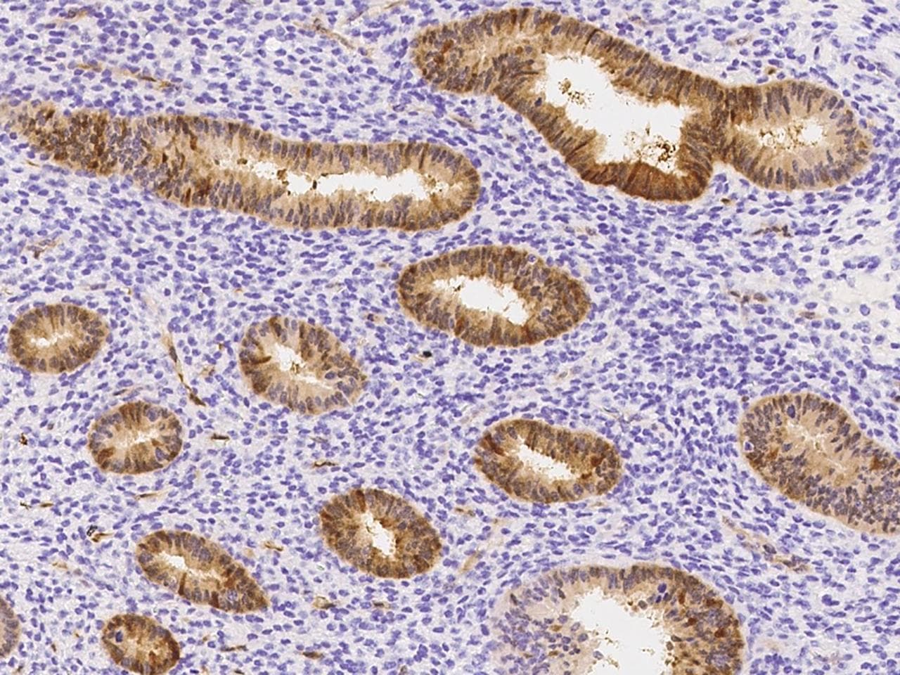 Polyclonal Rabbit anti-Human Latexin / MUM Antibody (Preservative Free, IHC, WB)