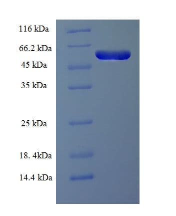 Human RMND5A Protein (Recombinant His-SUMO)