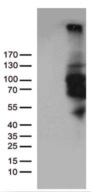 PDE3B Antibody (aa654-1073, clone OTI3F5)