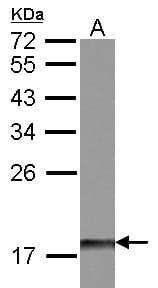 DUSP26 / MKP8 Antibody (aa22-117)