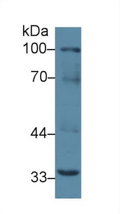 TNFRSF11A / RANK Antibody (aa359-542, APC)