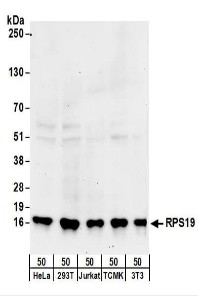 RPS19 / Ribosomal Protein S19 Antibody (aa95-145)