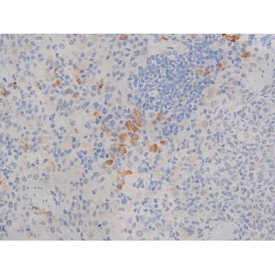 MAPT / Tau Antibody (phospho-Ser214)