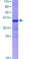 Human KDM5A / JARID1A Protein (Recombinant GST)