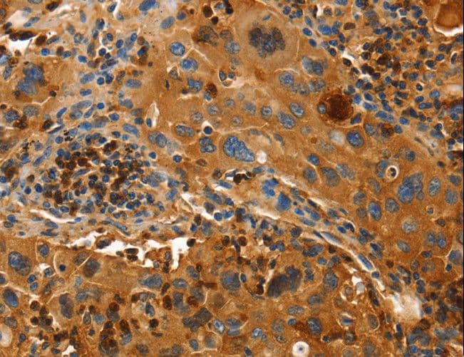 IHC-plus™ Polyclonal Rabbit anti-Human ORM2 / Orosomucoid 2 Antibody (IHC, WB)