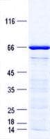 Human HOXA11 Protein (Recombinant GST, N-terminus + His, C-terminus)