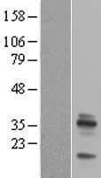 EMD / Emerin Protein (Over-Expression Lysate Myc-DDK (Flag))
