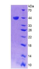Human TREX1 Protein (Recombinant 6His, N-terminus)