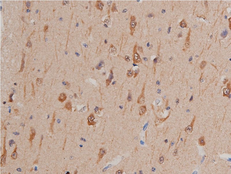 Polyclonal Rabbit anti-Human GSK3A / GSK3 Alpha Antibody (IHC, WB)
