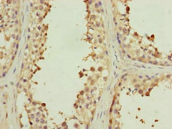 MYLIP / IDOL Antibody