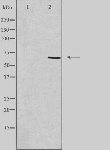 ADCK5 Antibody