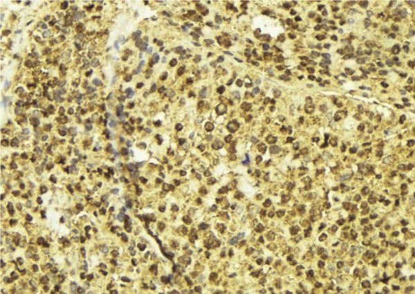 Polyclonal Rabbit anti-Human OTX2 Antibody (IHC, WB)