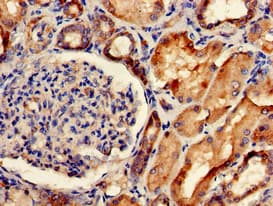 Polyclonal Rabbit anti-Human SORCS2 Antibody (aa712-786, IHC, IF)