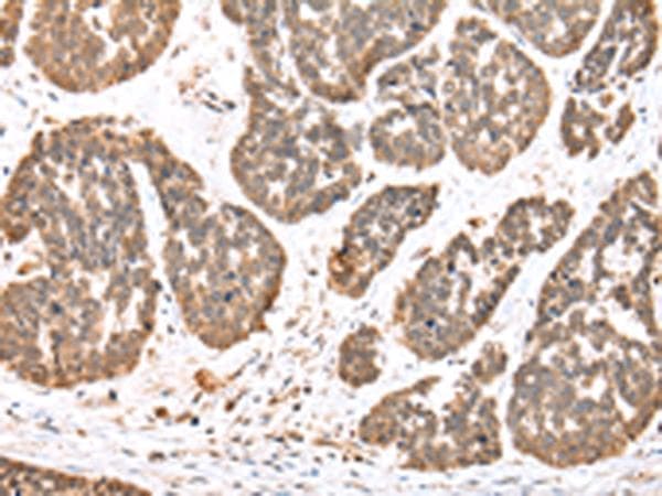 DDX58 / RIG-1 / RIG-I Antibody