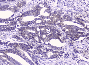 GOLPH3 Antibody