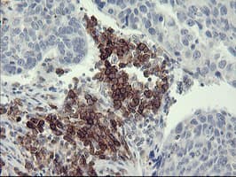 Monoclonal Mouse anti-Human CD45 / LCA Antibody (clone OTI2E7, IHC, IF, WB)